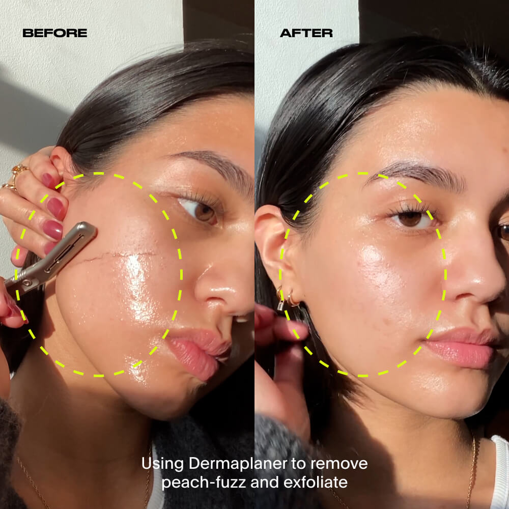 A before and after of the cheek using the dermaplaner